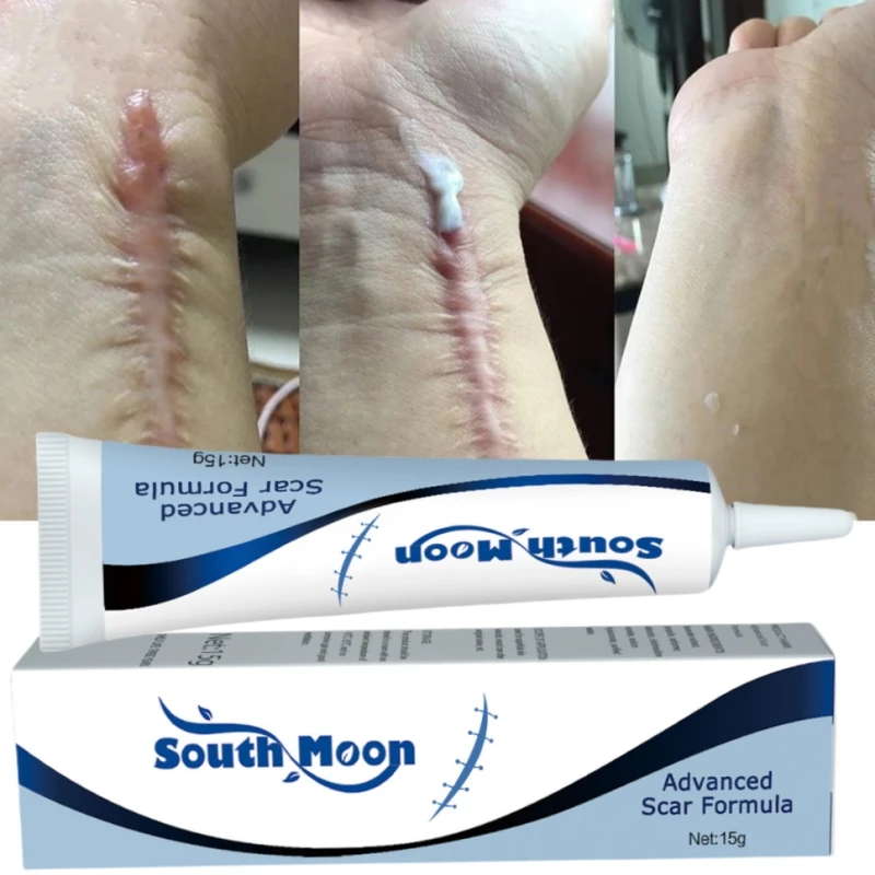 Крем для удаления шрамов со старыми шрамами новинка шрамы хирургические