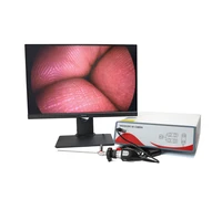 medical full hd endoscope camera laparoscopic 1080p endoscopy camera
