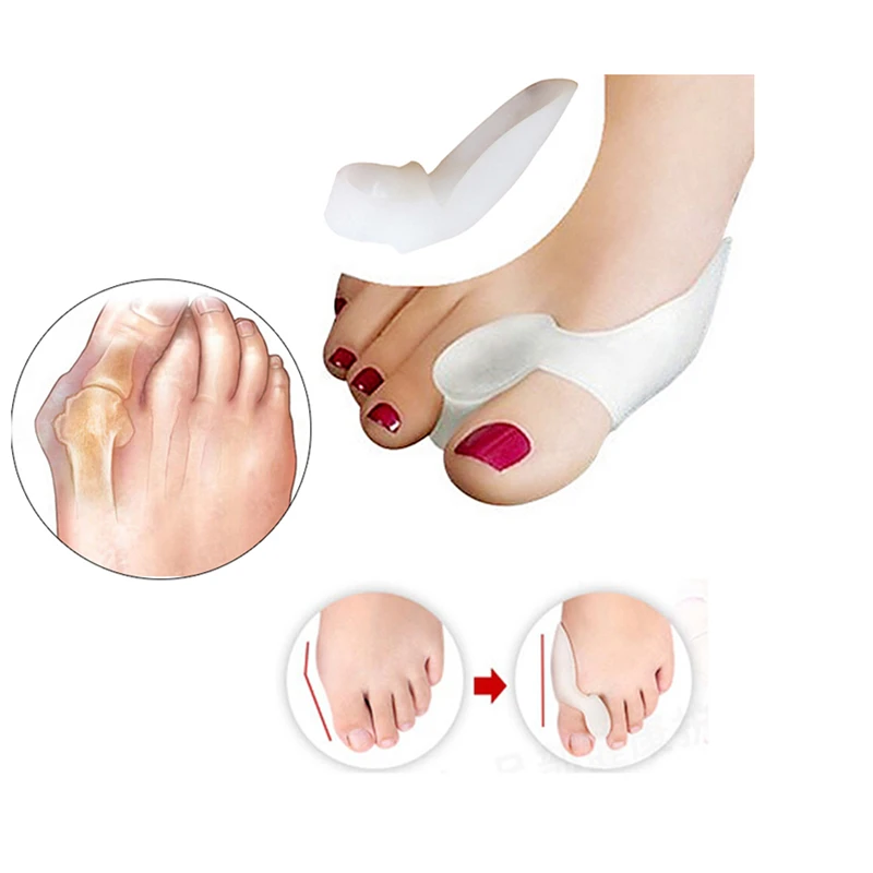 

1 пара, силиконовый разделитель для большого пальца ноги при вальгусной деформации