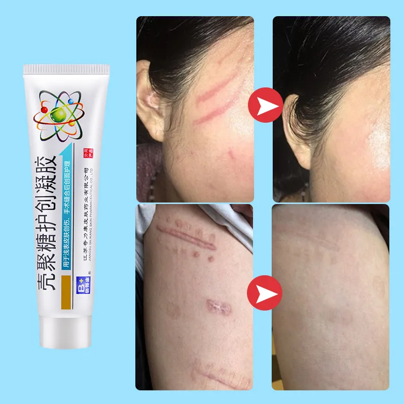 

Scar Repair Cream Repairing Removing Burn Scars Promote Cell Regeneration Enhance Elasticity Cucumber Skin Care