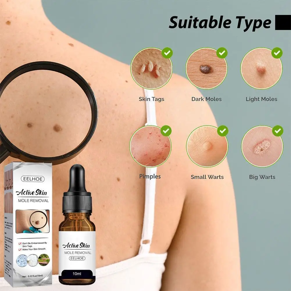 

Body Care Solution Mole And Wart Essence Skin Face Repair Cleaning Armpit Removal Neck Care Meat Q9k4