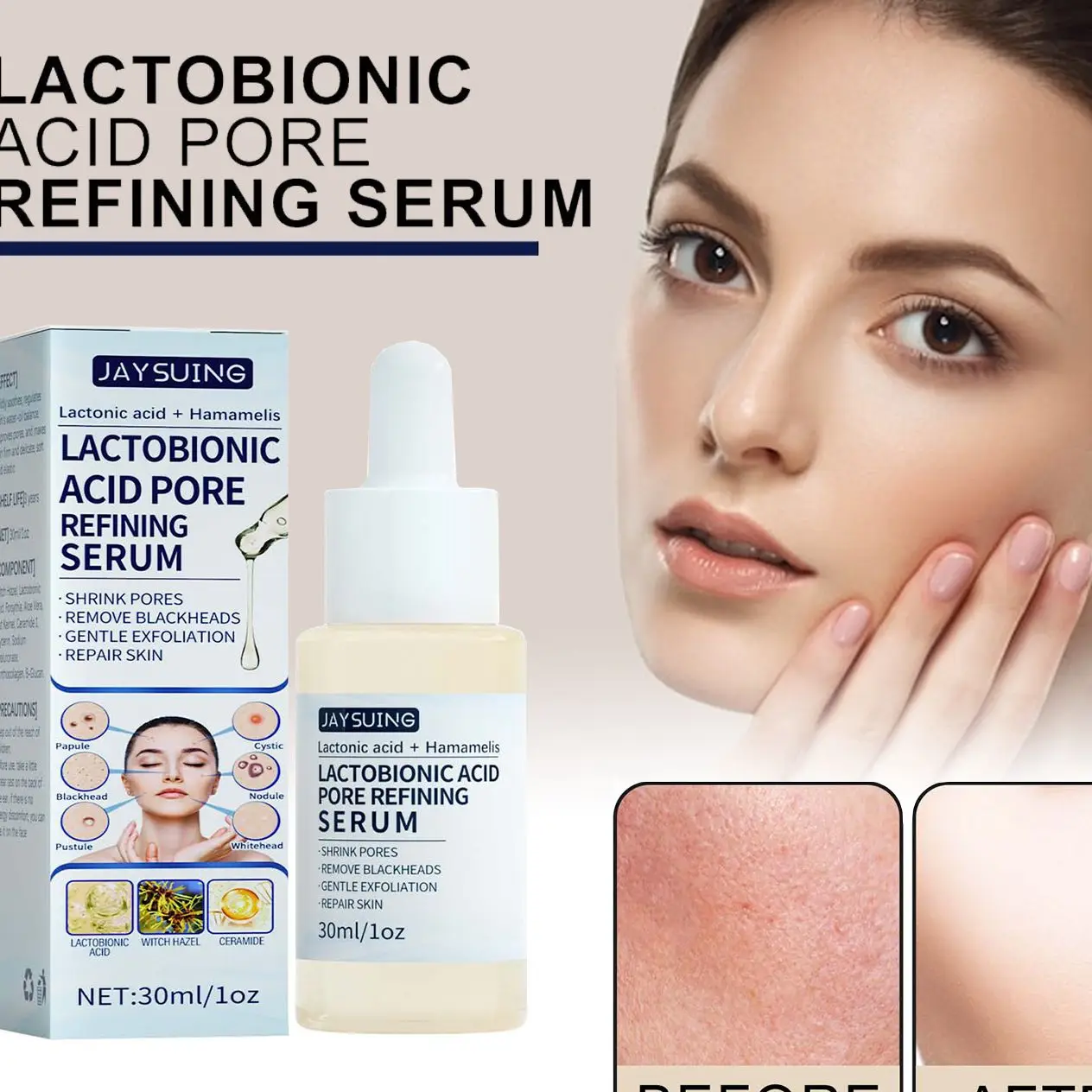 

Lactose Acid Stock Solution 30ml Deeply Cleans Gently Exfoliates Removes Blackheads Contracts Pores And Moisturizes Skin