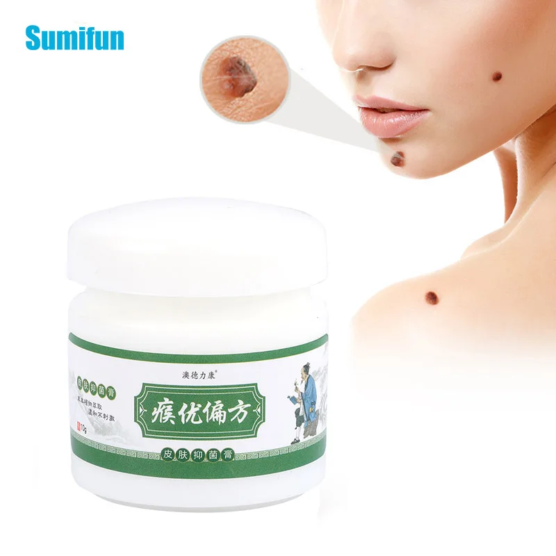 

15g Skin Tag Remover Ointment Against Mole & Genital Wart Fast Remove Foot Corn Warts Papillomas Rapidly Removes Moles Cream