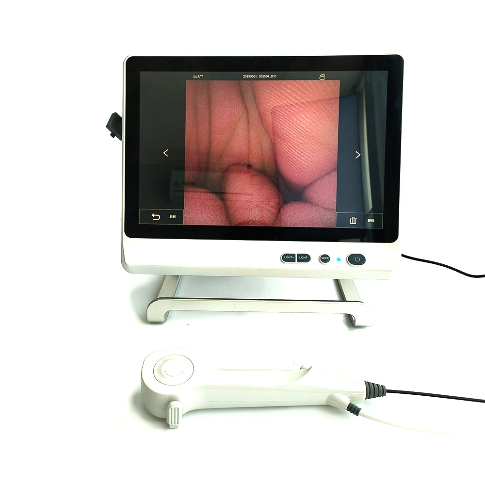 Гибкий видео уретероскоп одноразовый цифровой урологический