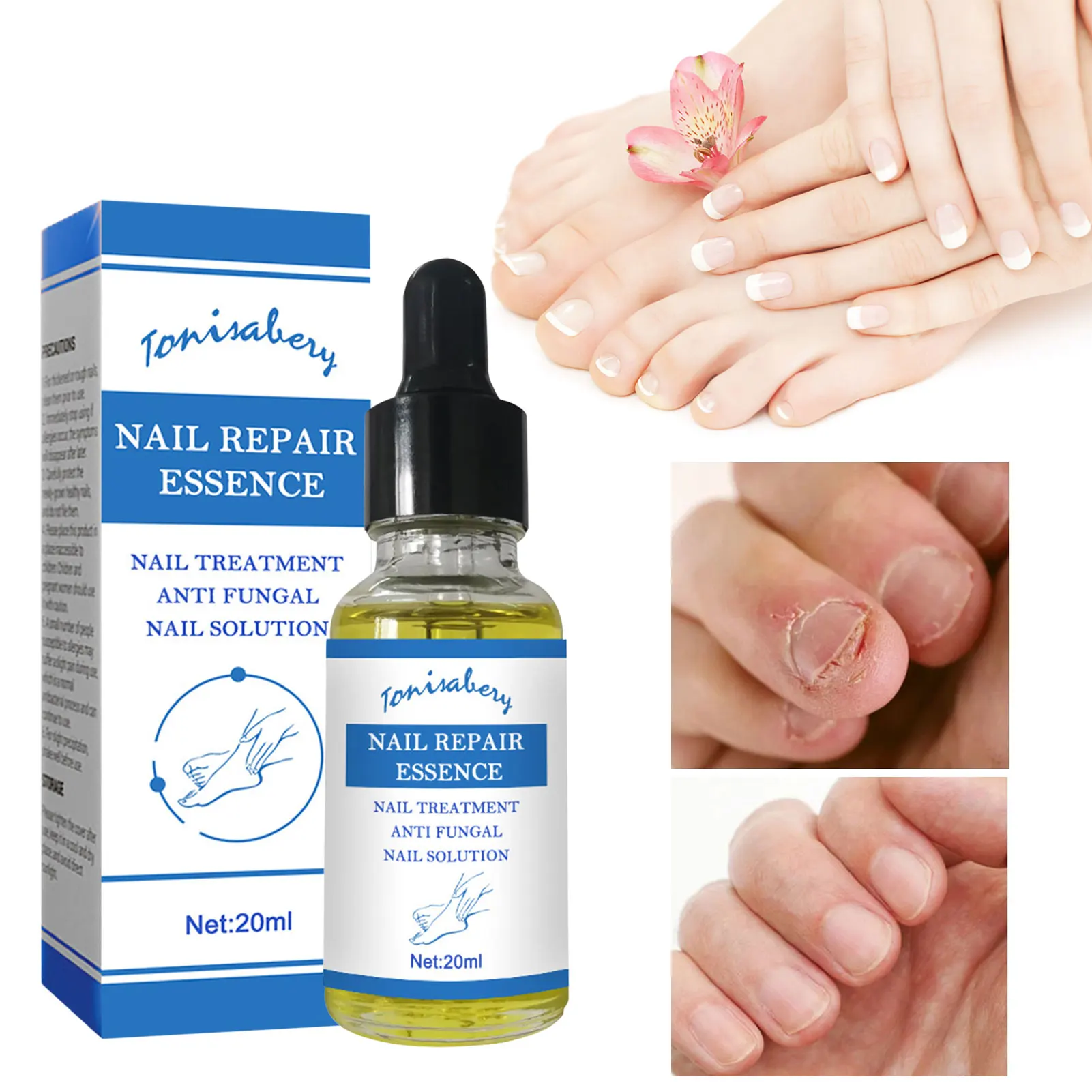 

Nail s Essence Feet Care Serum Nails Fungous Foot Toe Fungous Removal Gel Anti Paronychia Onychomycosis Repair