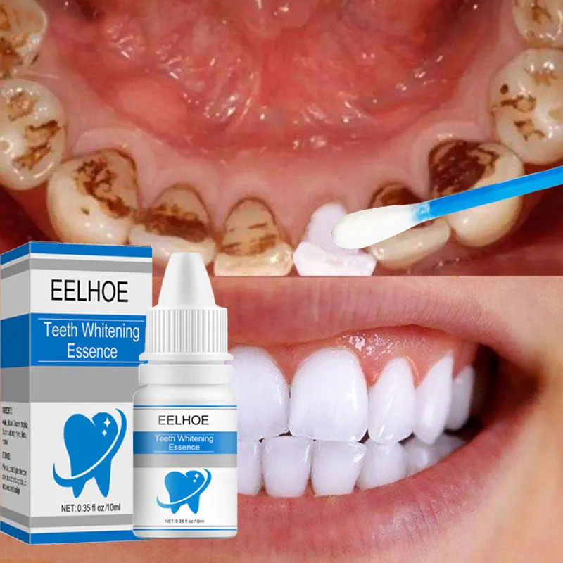 

Teeth Whitening Essence Remove Plaque Stains Serum Fresh Breath Oral Hygiene Against Dental Caries Dental Tooth Bleaching Tools