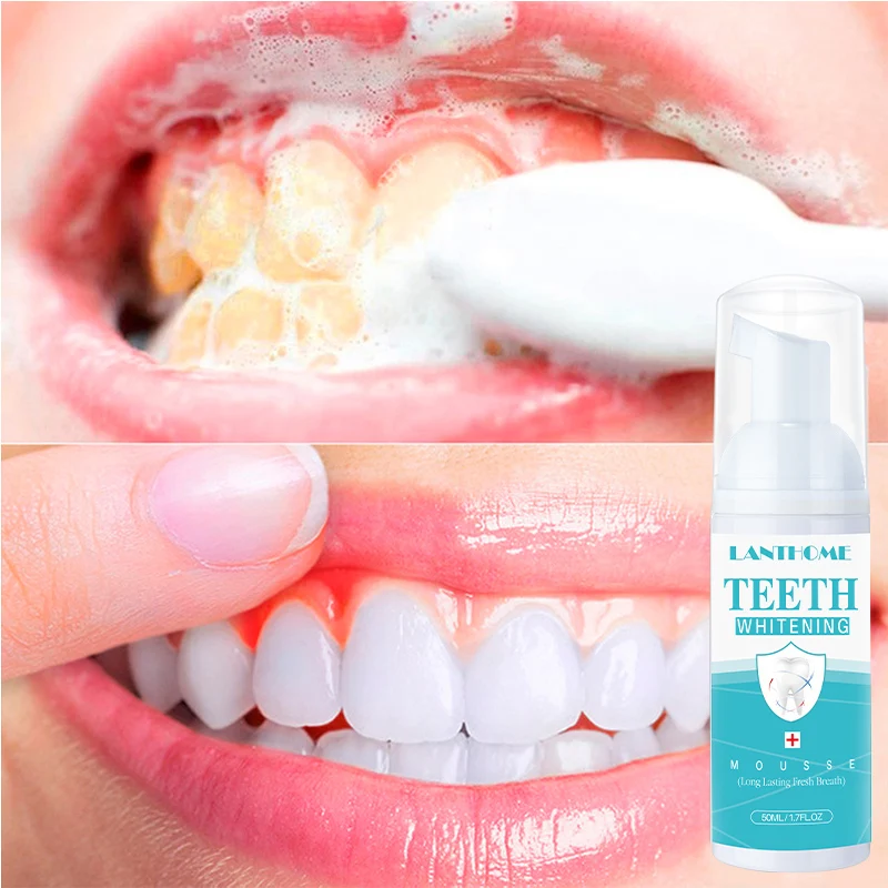 

Teeth Cleansing Whitening Mousse Baking Soda Toothpaste Foam Toothpaste Removes Stains Fresh Breath Dental Care Tools 50ml