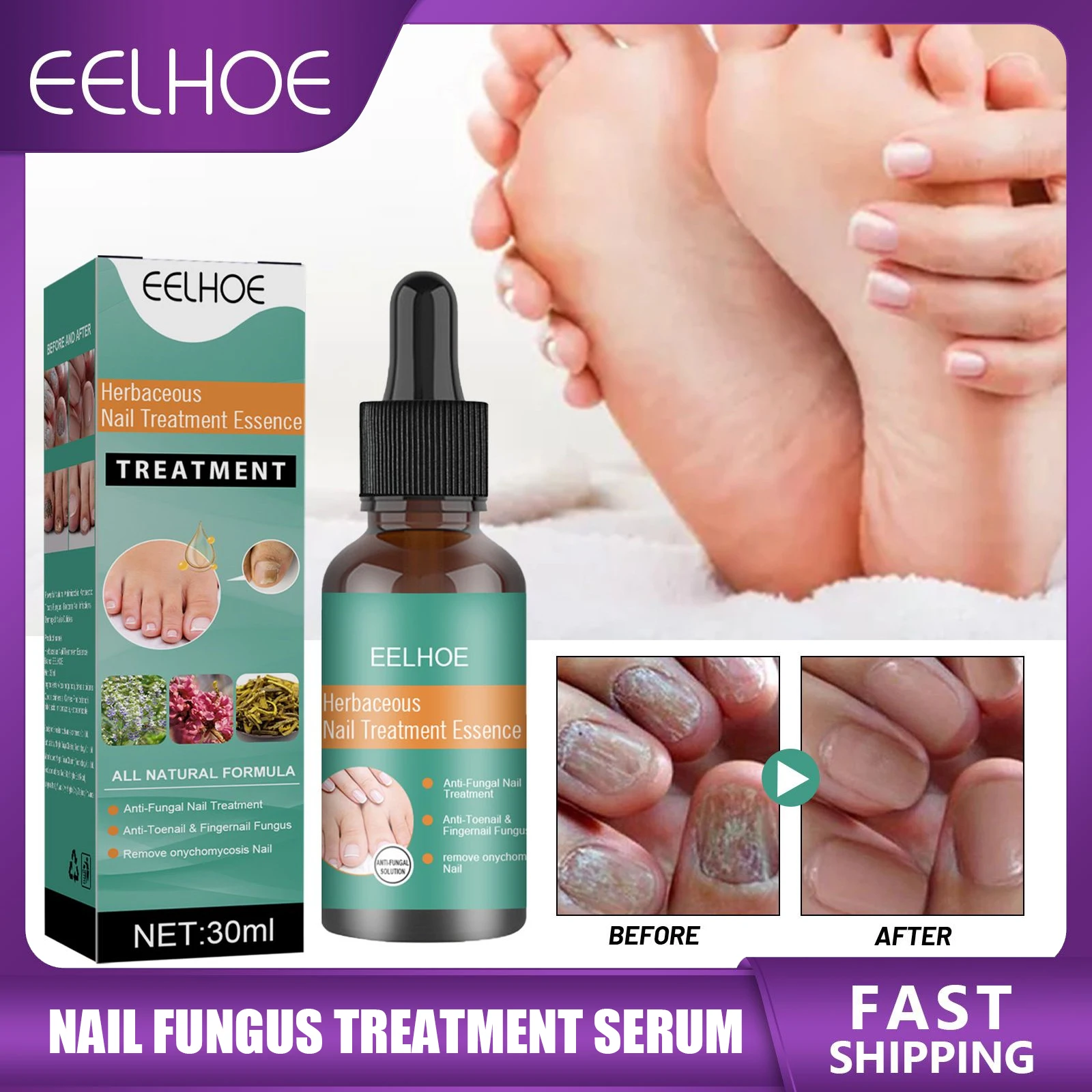 

Nails Treatment Essence Nail Fungus Repair Lotion Fungal Removal Improve Thicken Rough Nails Restore Nail Shine Feet Care Serum