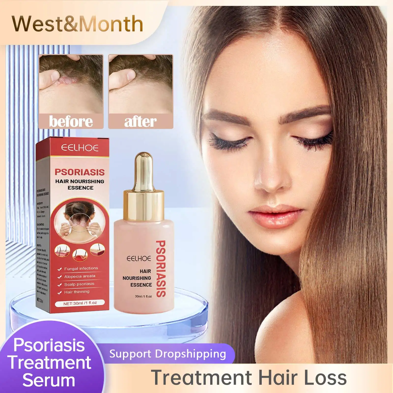 

Hair Scalp Treatment Essence Psoriasis Anti Dandruff Treatment Relieve Flaking Itching Follicle Booster Nourishing Hair Serum