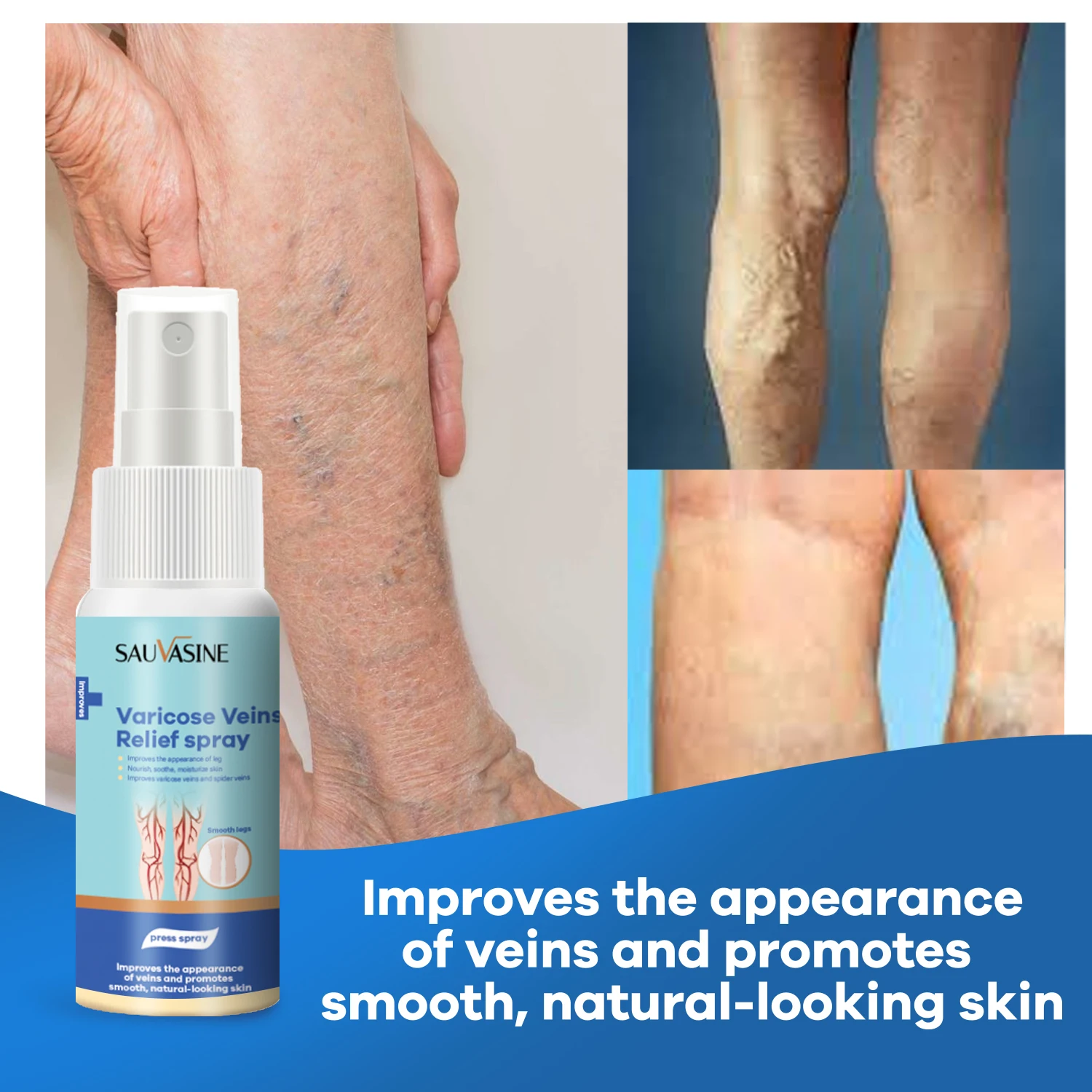 

Спрей для облегчения варикозного расширения вен, флебит, паук, медицинский пластырь, уход за телом 30 мл