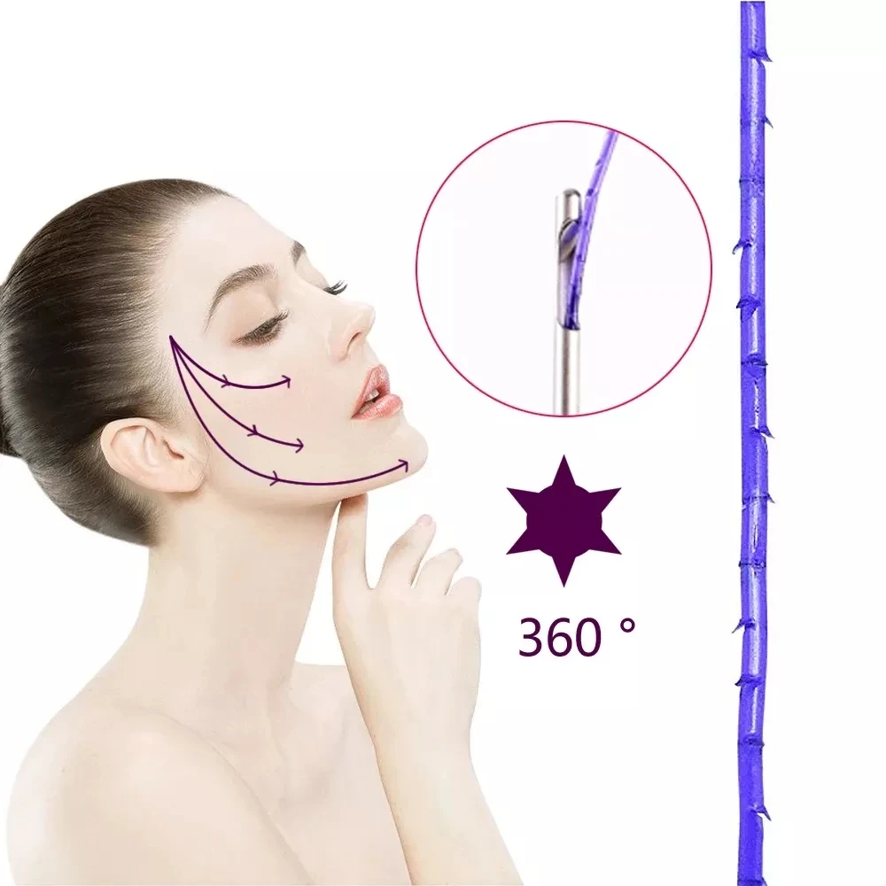 

Top selling KING lift fishbone molding cog 3D 4D 6D L W blunt 18G19G21G100mm 120mm pdo thread lift Disposable