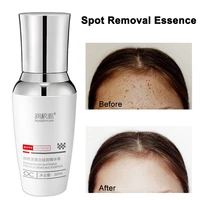 rungenyuan spot removal essence for face beauty care face products skin care sets serums korean skincare hyaluronic serum toner