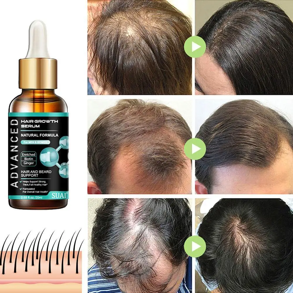 

Hair Nourishing Solution Fast Liquid Treatment Scalp Beauty Care Hair Follicle Health Loss Anti Hair Natural Hair A7Z0