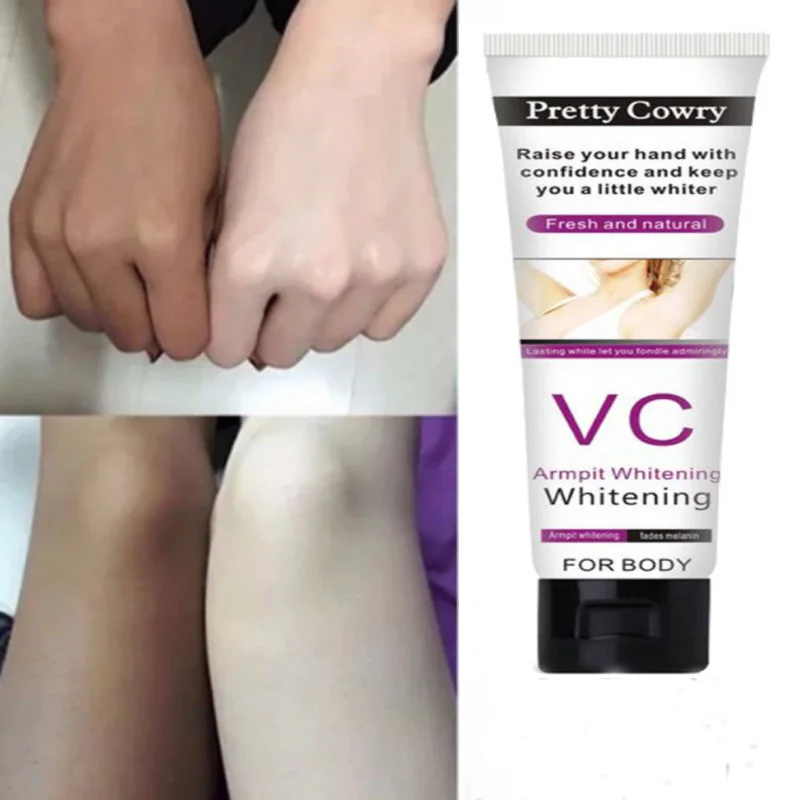 

Whitening Cream Body Dark Black Skin Whitening Face Cream Armpit Private Parts Buttock Elbow Knee Underarm Melanin Removal Cream