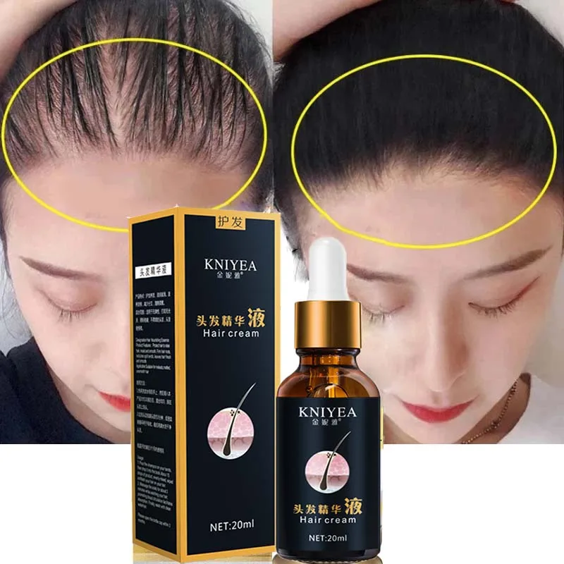 Уход За Волосами Эфирные масла для роста волос эссенция оригинальная Подлинная