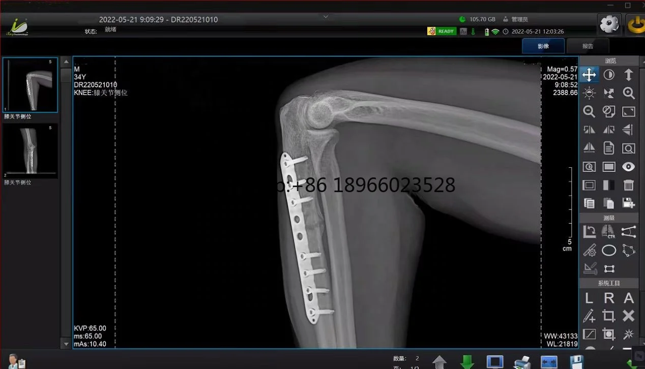 Специальное предложение 17*17 дюймов медицинская цифровая dr панель проводной 1717
