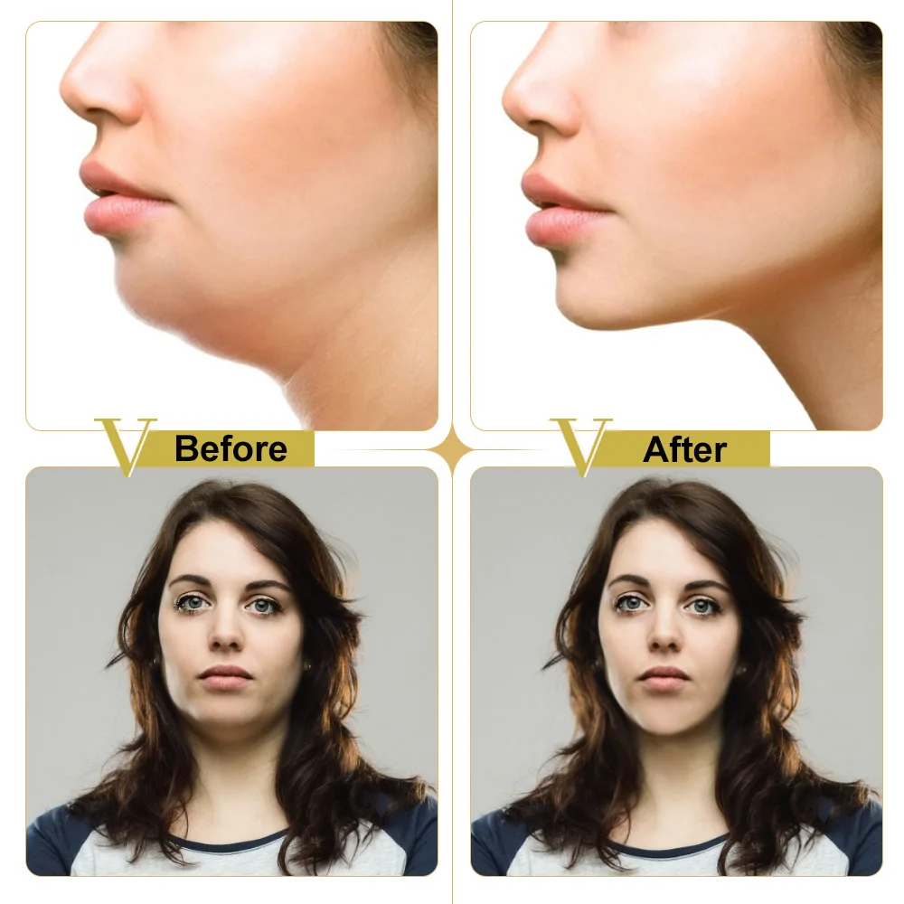 Reusable Silicone Face Lift Mask Soft Gel Anti Wrinkle Tape Skin Whiten Bandage Slimming Belt V Shape Patch Reduce Double Chin images - 6