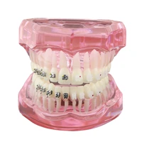 dental orthodontic teeth model m3003 pink typodont with half metal ceramic bracket comparison demonstration teaching study