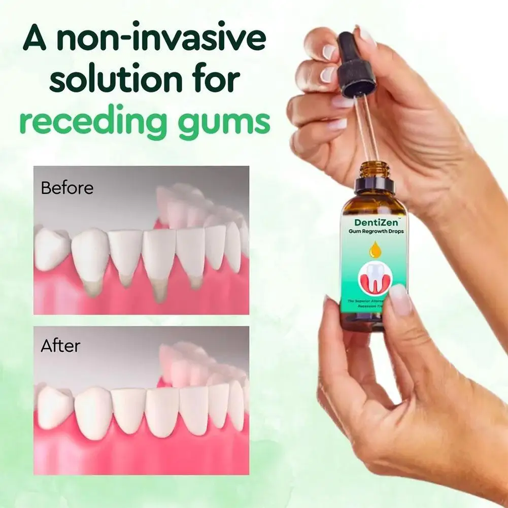 

Dentizen Gum Regrowth Drops Relieve Mouth Periodontal Gum Pain Treatment Bad Breat Antibacteria Oral Clean Care 30ML