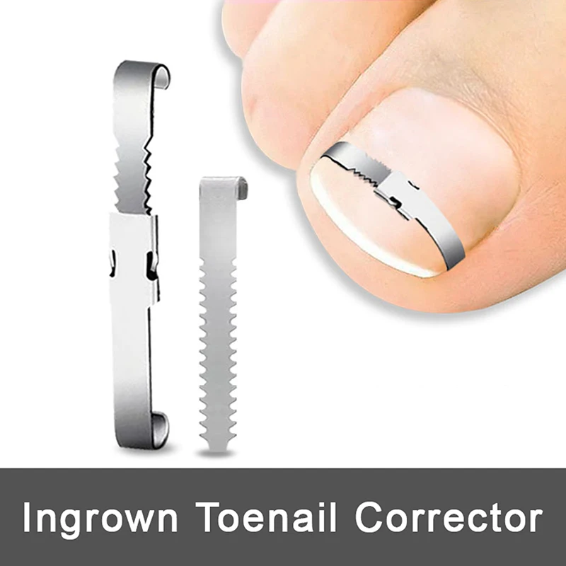 

Professional Ingrown Toenail Corrector Tools Pedicure Recover Embed Toe Nail Treatment Foot Care Correction Care Adjustable