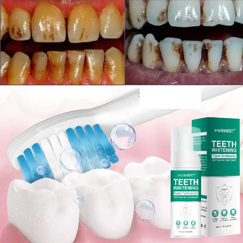 

30ml Teeth Whitening Mousse Dental Care Essence Remove Plaque Tooth Stain Gingival Repair Caries Prevention Oral Cleaning Tooth