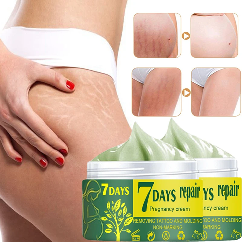 

Pregnancy Repair Cream Stretch Mark Removal Removal Acne Scar Stretch Marks Cream Fat Striae Gravidarum Treatment Body Creams