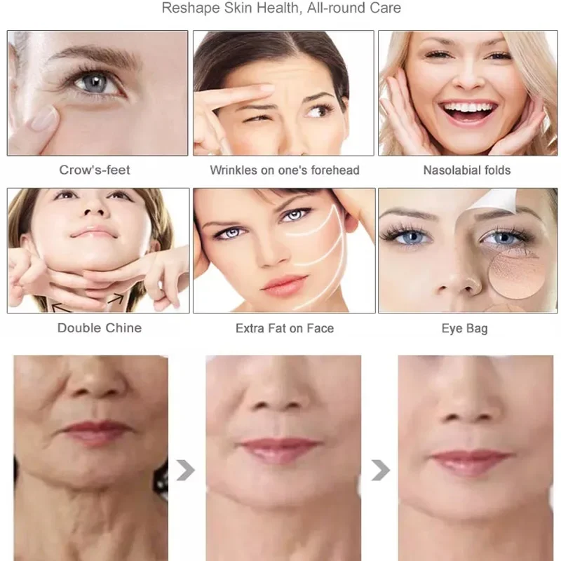 Au-S505 Auro аппарат для подтяжки лица удаления морщин V-Max