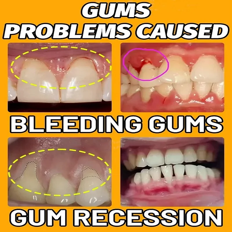 Сыворотка для быстрого восстановления десен