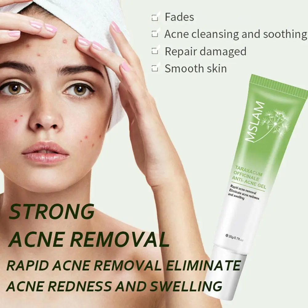 Эффективный крем для удаления прыщей травяное масло от увлажняющий отбеливающий