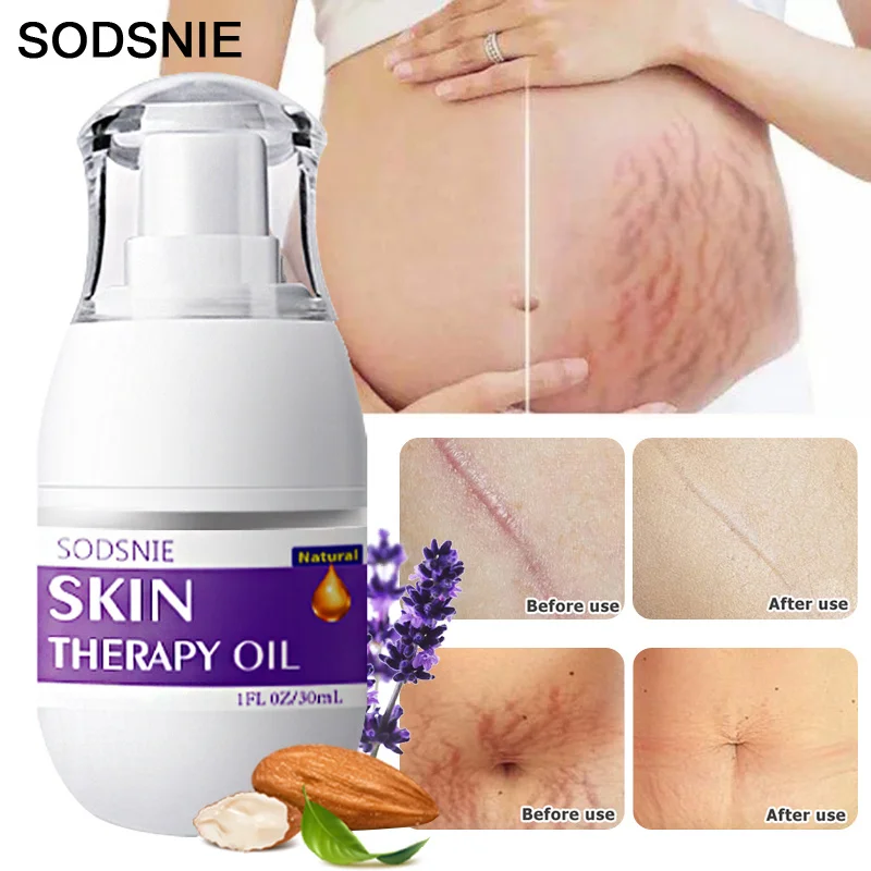 

Stretch Mark Removal Oil Repair Scar Fat lines Surgical Burns Scars Serum Firming Lifting Fade Pregnant Belly Wrinkle Oil 30ml