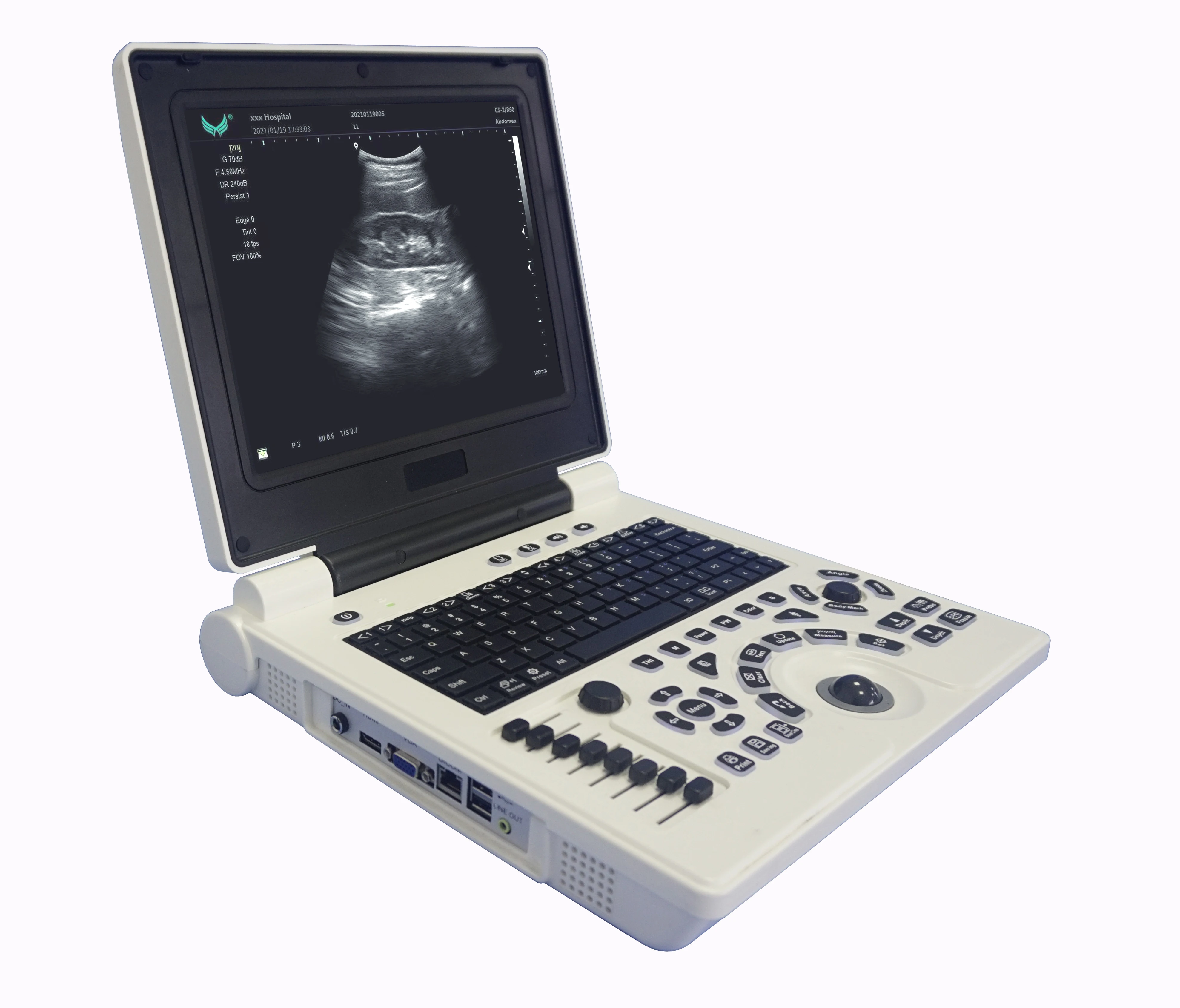 

new arrival P20 PW black and white ultrasound scanner supports convex,transvaginal,linear and micro convex