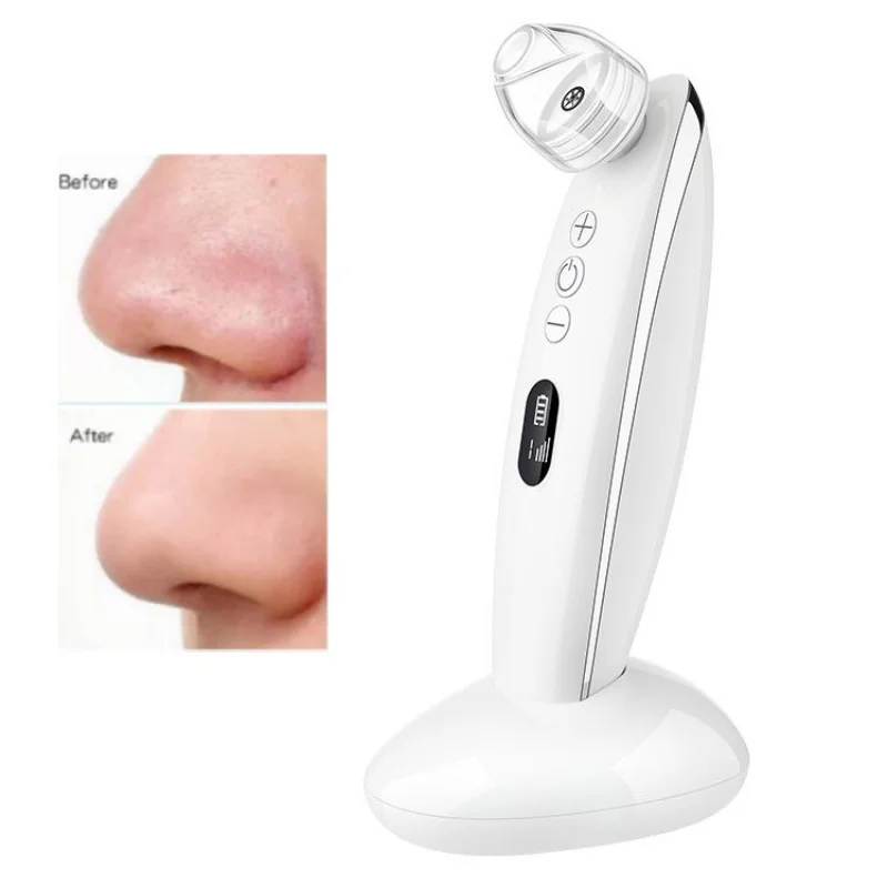 

Электрический инструмент для глубокой очистки лица, средство для удаления черных точек, вакуумный очиститель пор, прыщей, очиститель акне, инструменты для удаления черных точек на носу