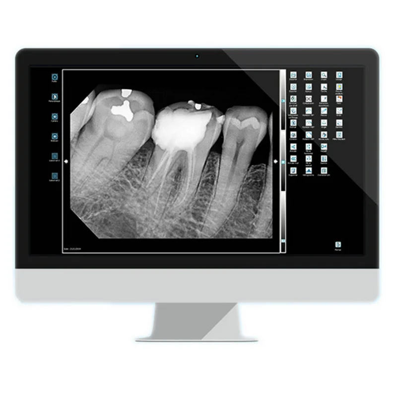 Сертификация CE Оборудование Den tal Мощное программное обеспечение для управления