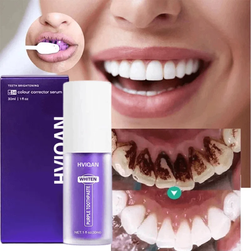 V34 Tooth Colour Corrector 30ml Smoke Stain Remove Teeth Whitening Toothpaste  Reduce Yellowing Oral Cleansing Enamel Care