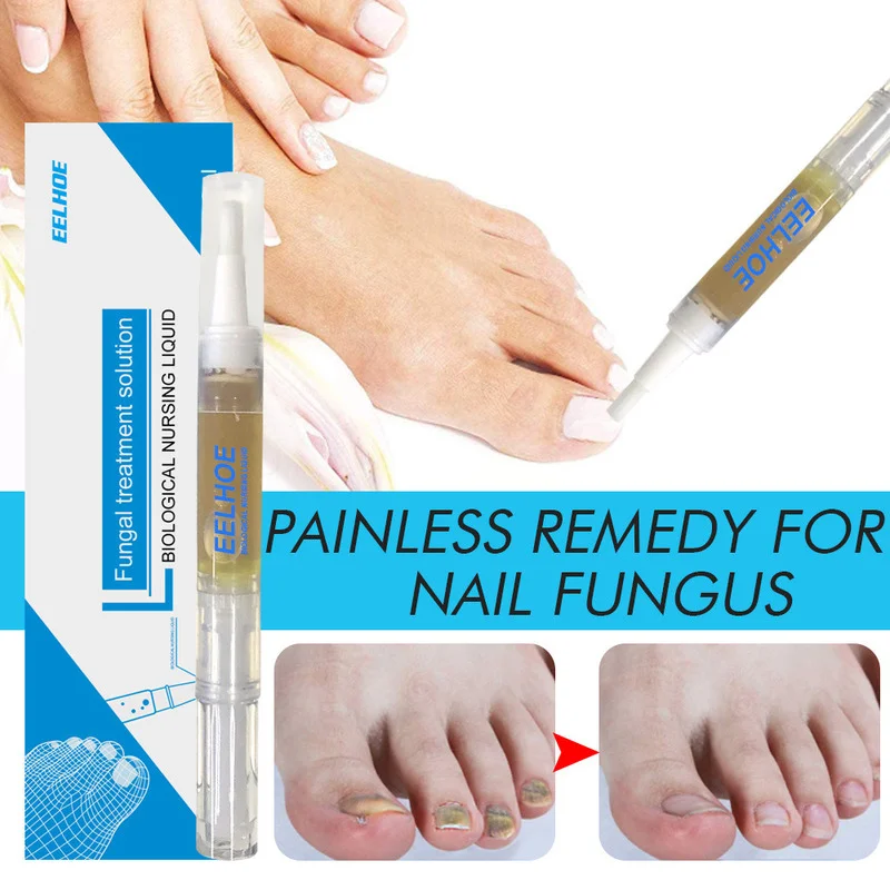 

3ml Nail Fungal Treatment Solution Anti Toenail Fungus Nail Treatment Pen Cuticle Oil Pen Nail Care Solution Nail Treatment Tool