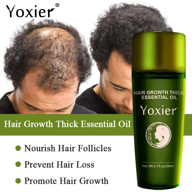 Hair Growth Thick Essential Oil Nourish Prevent Hairs Loss Fast Regrowth Improve Frizz Repair Scalp Massage Treatments Care 20ml