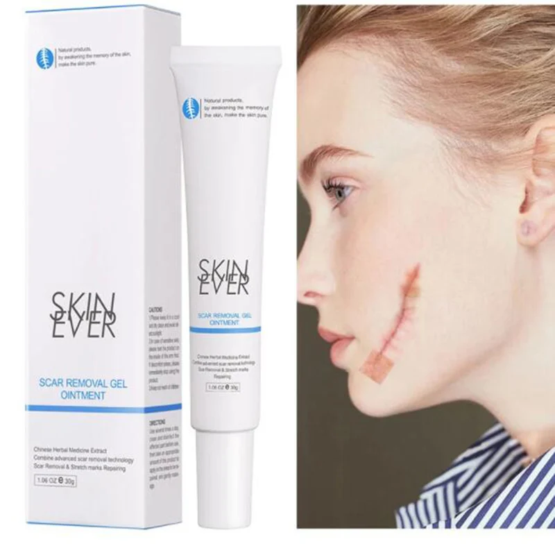 

30g Scar Remover Cream Acne Scar Removal Cream Gel Stretch Marks Pimples Scald Smoothing Whitening Moisturizing Women Skin Care