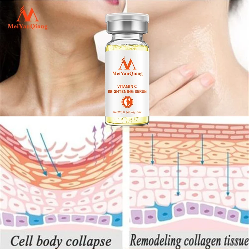 

Vitamin C Whitening Facial Serum Anti Aging Moisturzing Serum Face Care VC Remove Dark Spots Serum Anti Wrinkle Skin Care Women