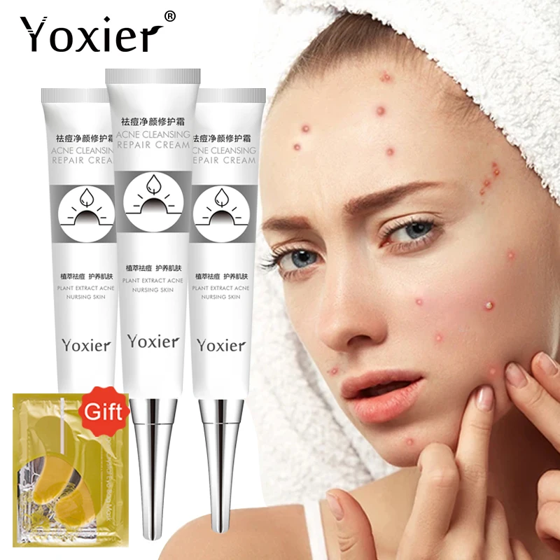 

Yoxier Acne Cleansing Repair Cream Remove Blackhead Shrink Pores Oil Control Anti-Aging Nourish Brighten Face Skin Care 3Pcs