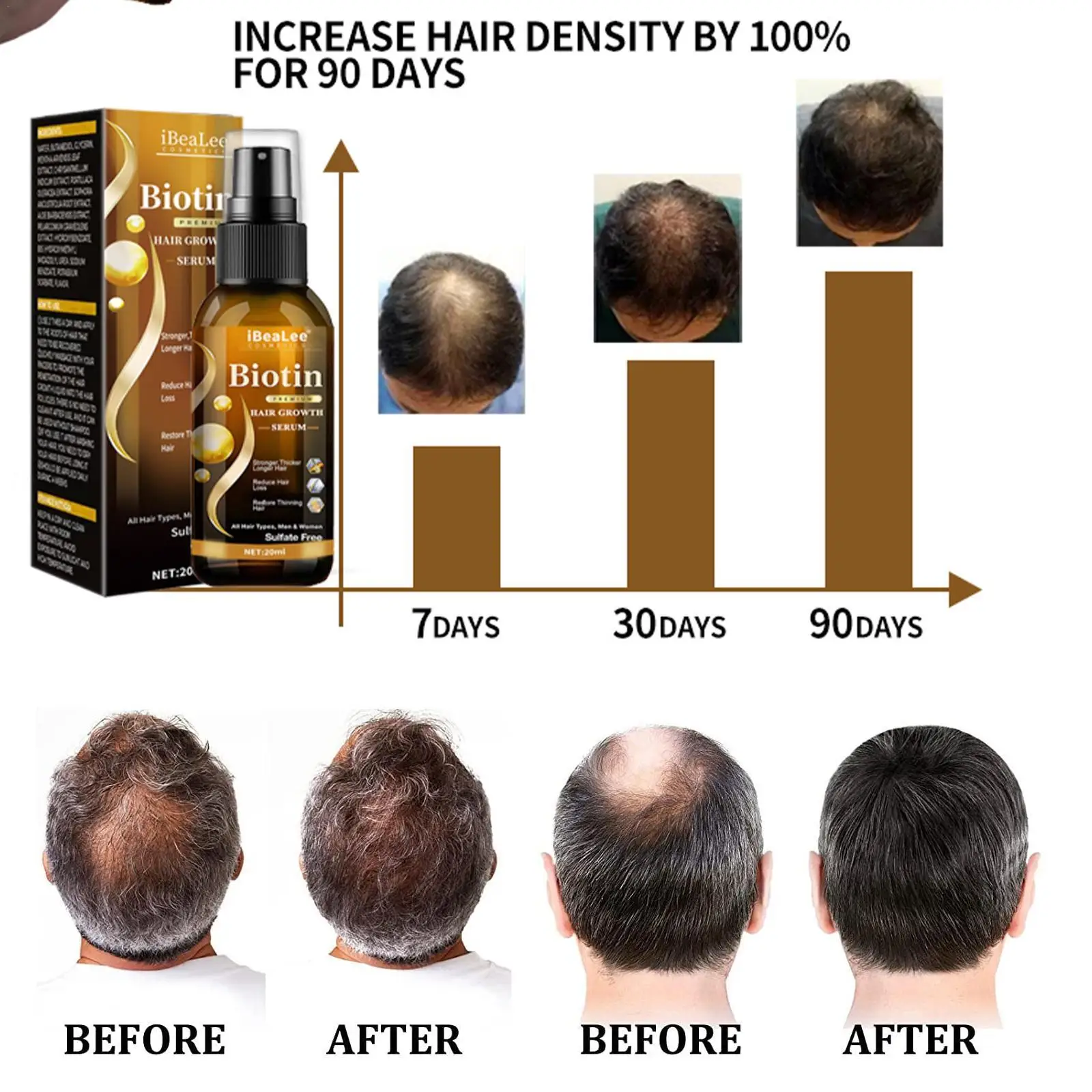 Hair Growth Products Biotin Fast Growing Hair Care Essential Oils Anti Hair Loss Spray Scalp Treatment For Men Women Hair Growth