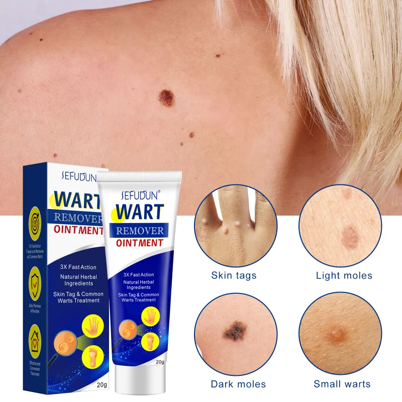 

Wart Remover Ointment Antibacterial Treatment Cream Skin Tag Rapidly Remove Armpit Moles Herbal Extract Whole Body Skin Care 20g