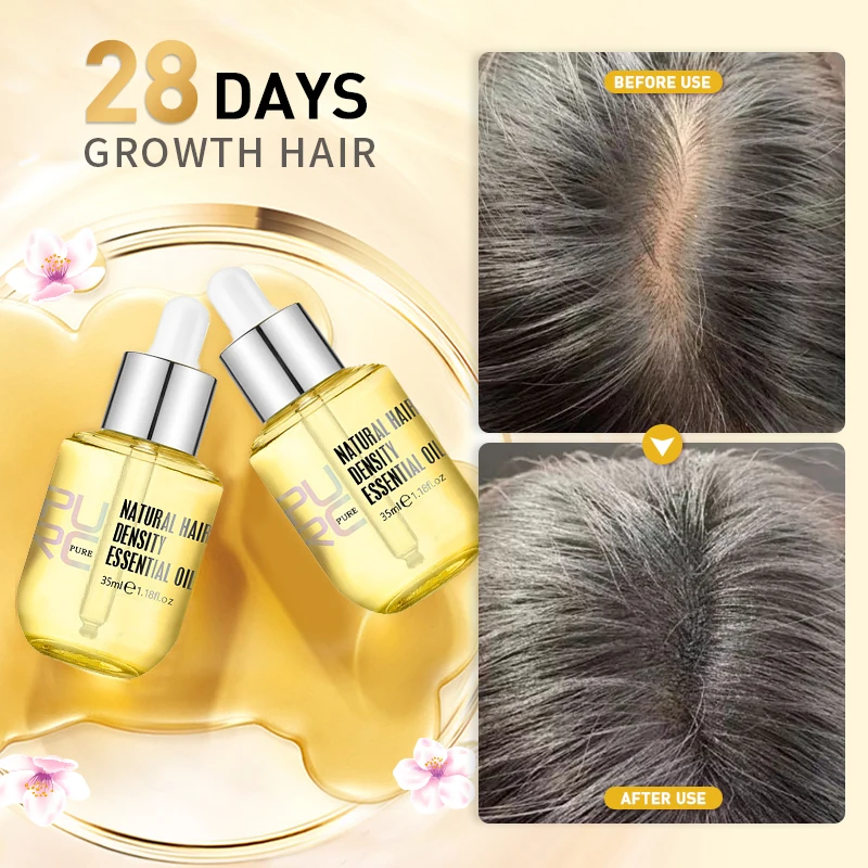 PURC Hair Growth Serum Ginger Extract Prevent Hair Loss Oil Scalp Treatments Fast Growing Hair Care Products for Women 35ml