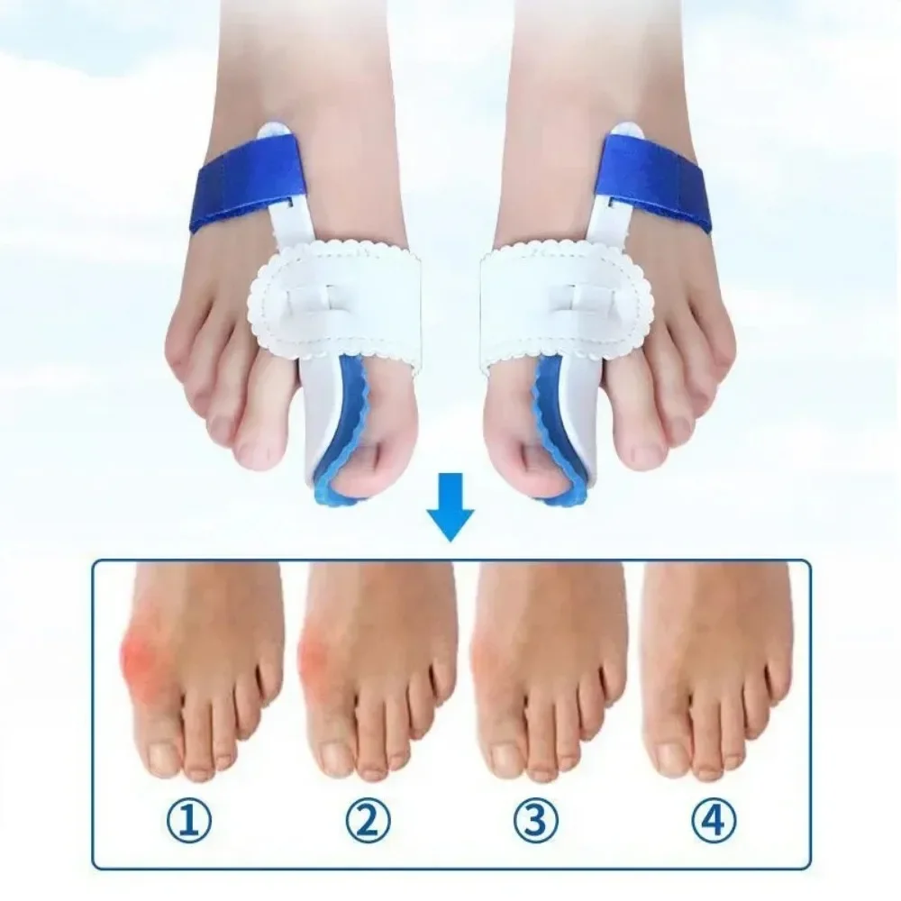 

2Pcs Toe Separator Hallux Valgus Bunion Corrector Orthotics Feet Bone Straightener Adjuster Pain Relief Pedicure Foot Care Tool