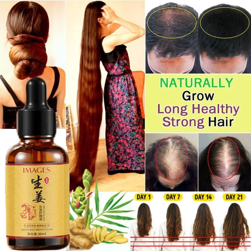 30ml Hair Growth Serum Fast Hair Growth Natural Ginger Hair Grow Oil Treatment of Scalp Hair Follicles hair growth products