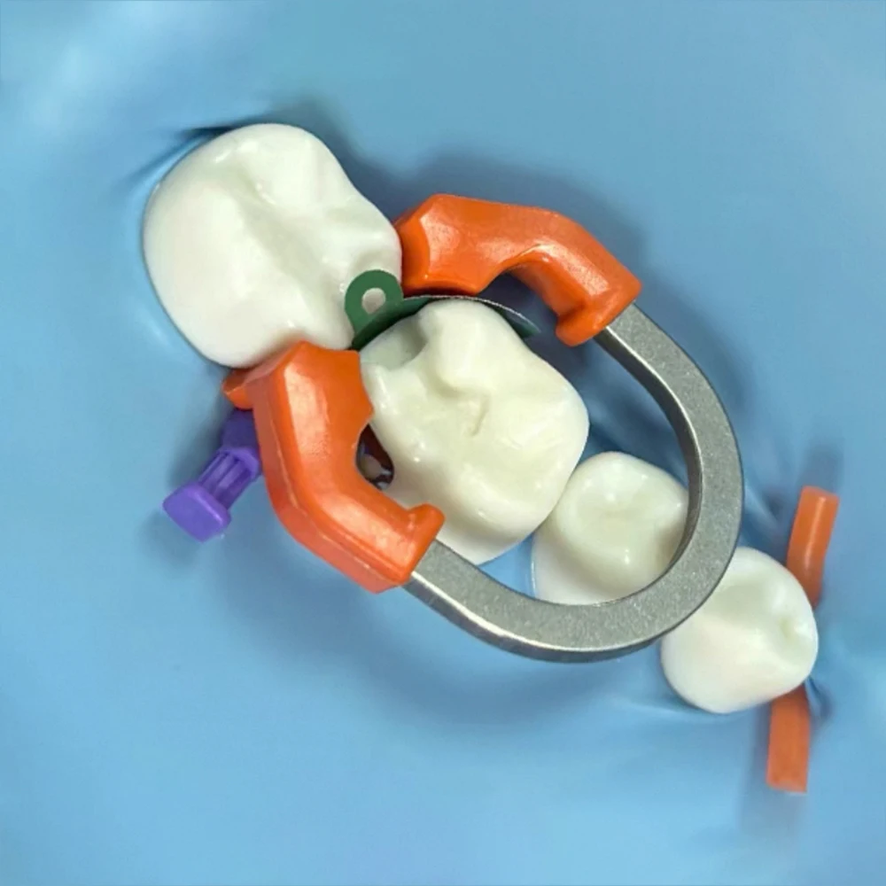 Bandas de matriz Dental система матрицы мгновенного действия Metalabrazadera anillo sujeción n