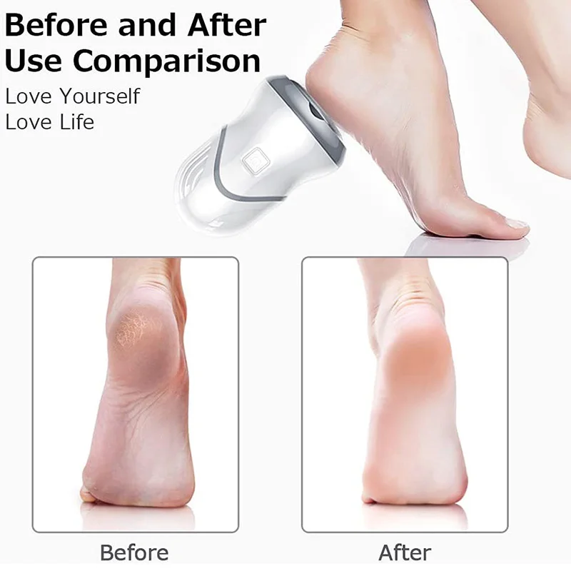 

New Electric Feet Callus Remover Professional Portable Foot File Pedicure Tools For Women Men Professional Portable