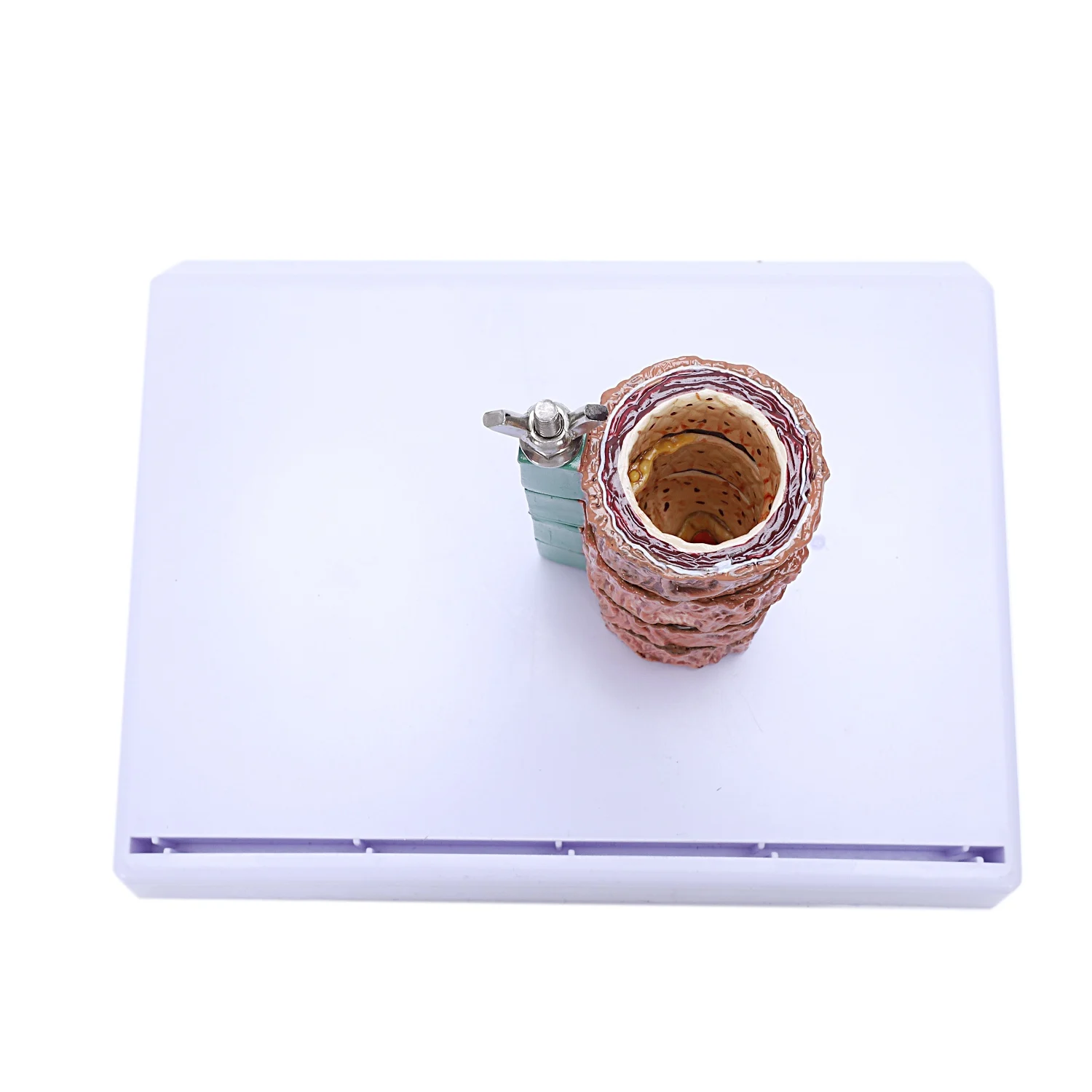 Модель тромбоза атеросклероза демонстрация сосудистых заболеваний модель