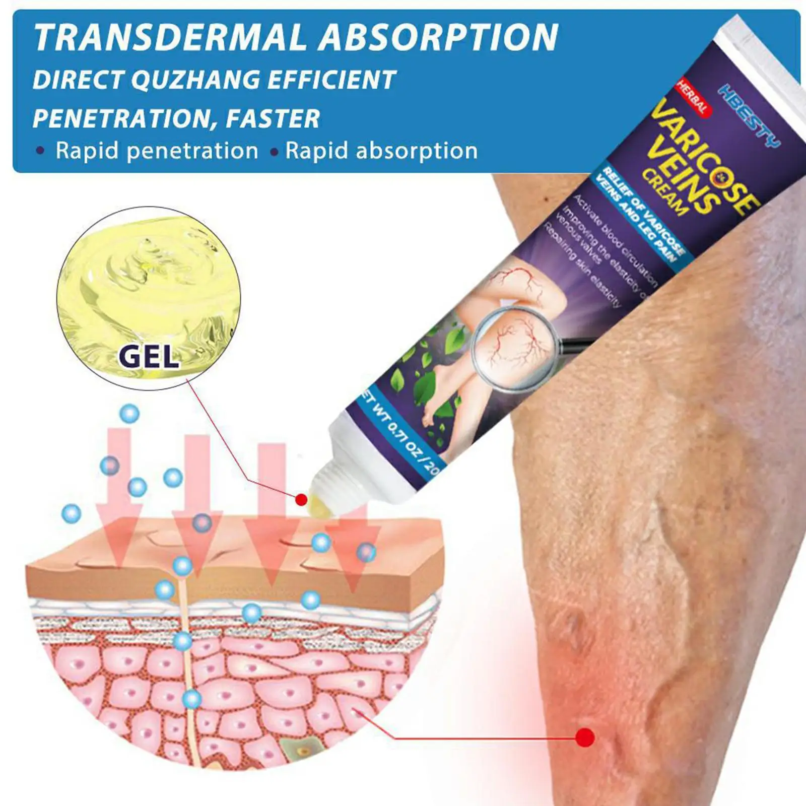

Эффективный крем для облегчения варикозного расширения вен, облегчение васкулита, флебит, паук, расширитель васкулита, флебит, паук для обл...