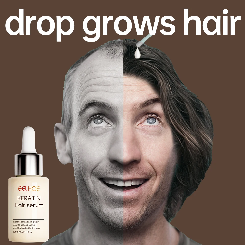 

Эссенция для сильного роста волос, эссенция против выпадения волос, восстанавливает и питает корни волос, для мужчин и женщин