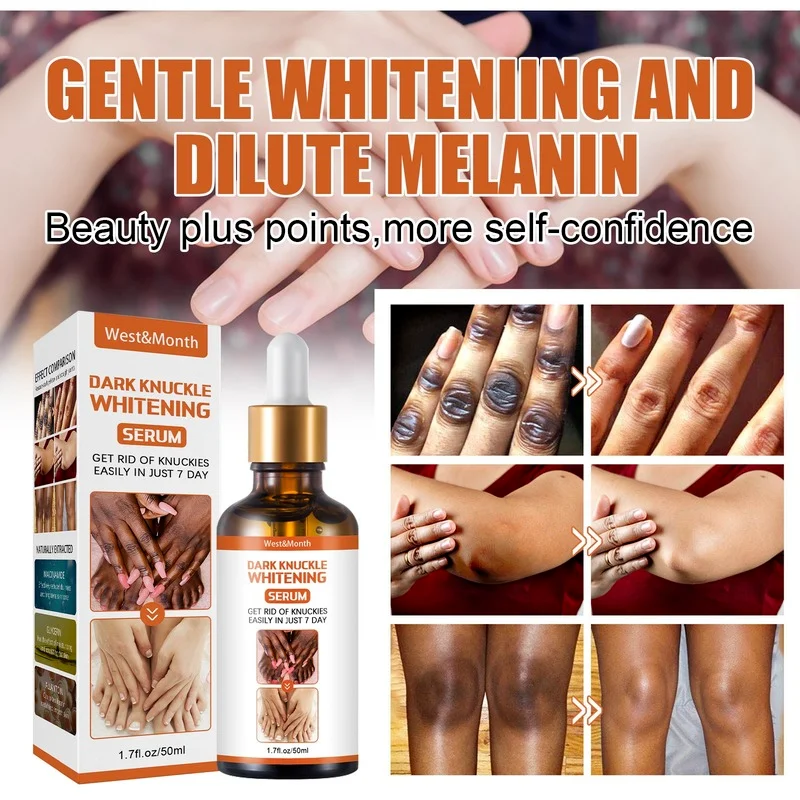 

Joint Darkening Serum Private Parts Underarm Lightening Melanin Brightening Skin Tone Moisturizing Moisturizing Body Whitening